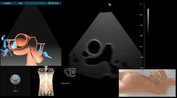 超聲模擬實(shí)訓(xùn)系統(tǒng) 單機(jī)版（女）